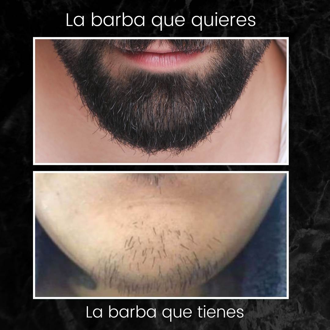 La barba de tus sueños