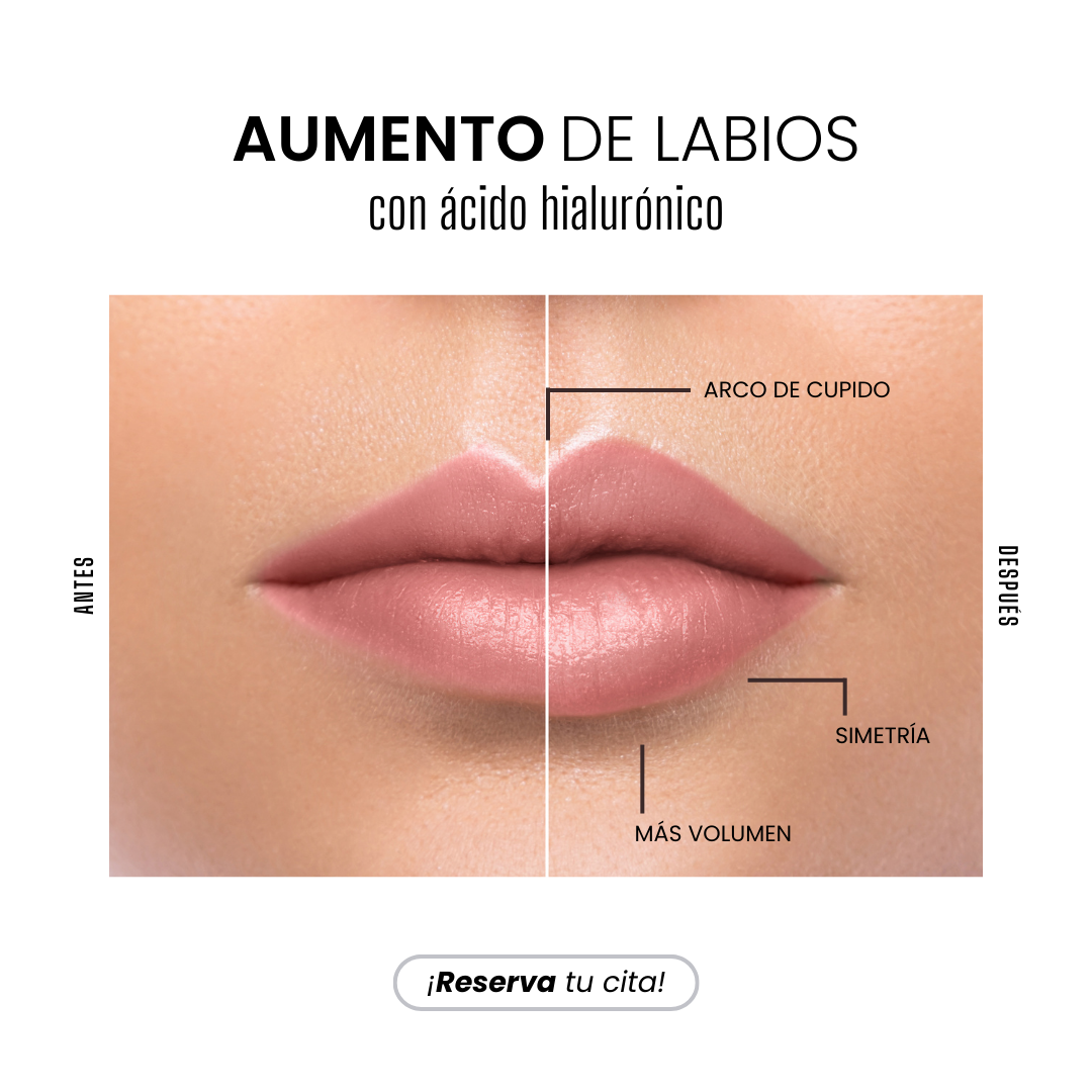 Labios voluminosos y naturales