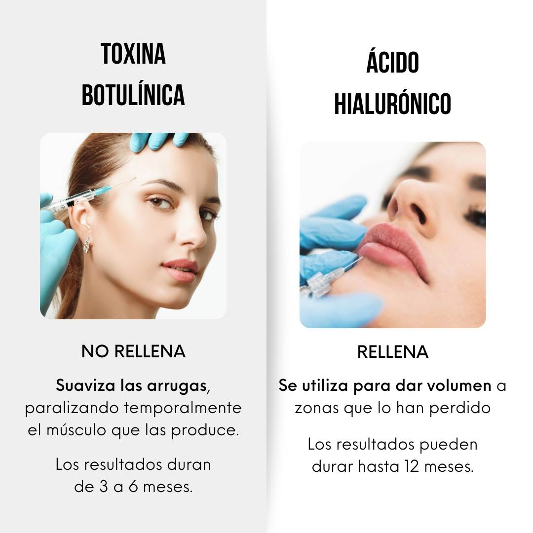 Bótox vs. Ácido Hialurónico