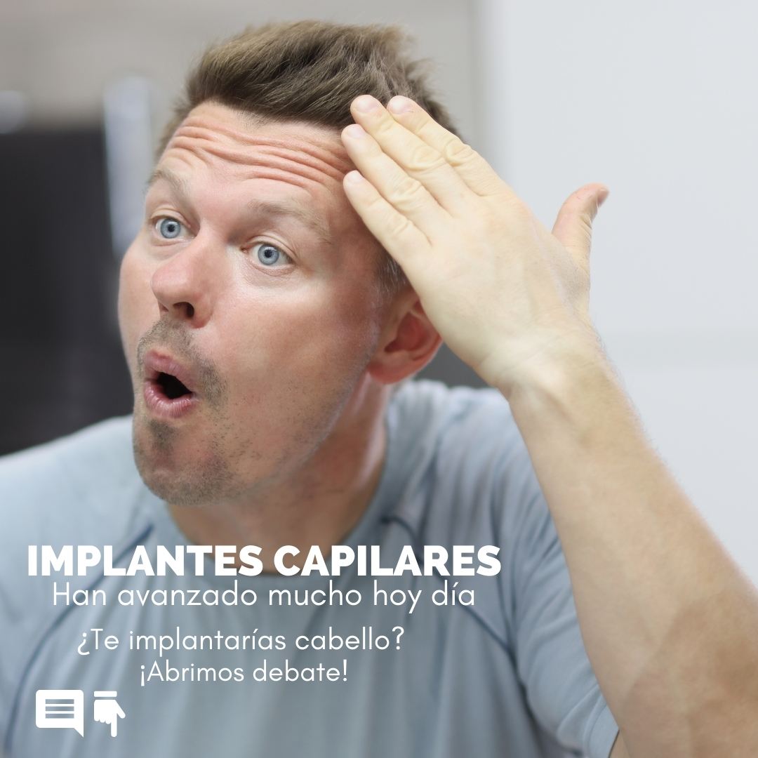 Debate Implantes Capilares actuales: Sí o No