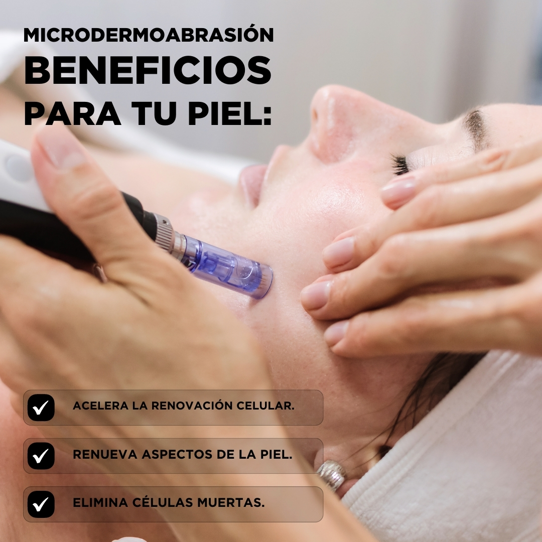 Microabrasión con punta de diamante