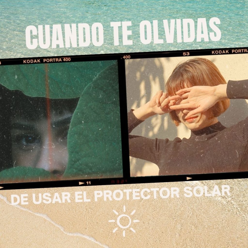 Cuando te olvidas de usar protector solar