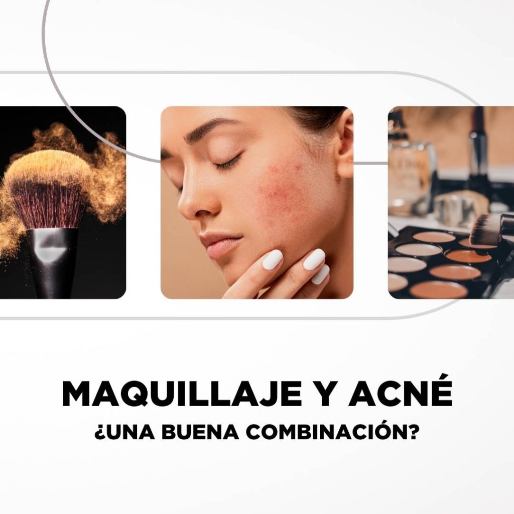 Maquillaje y Acné