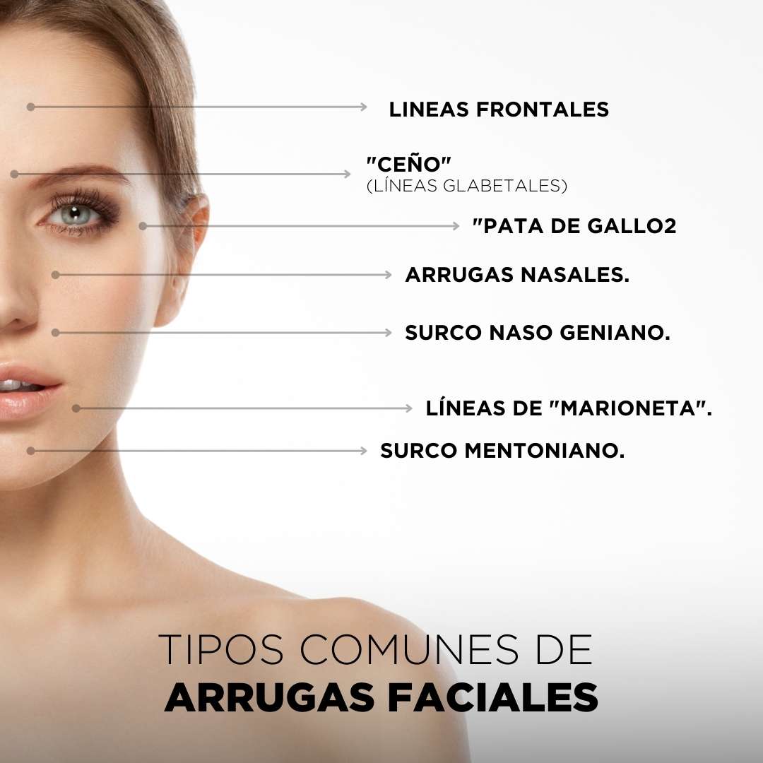 Tipos de arrugas faciales