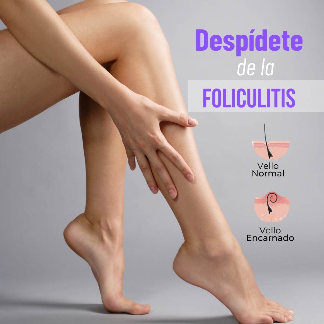 Adiós foliculitis, adiós pelos encarnados bye bye ¡Hola piel suave sin vello!