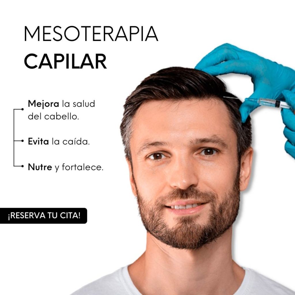 Mesoterapia capilar